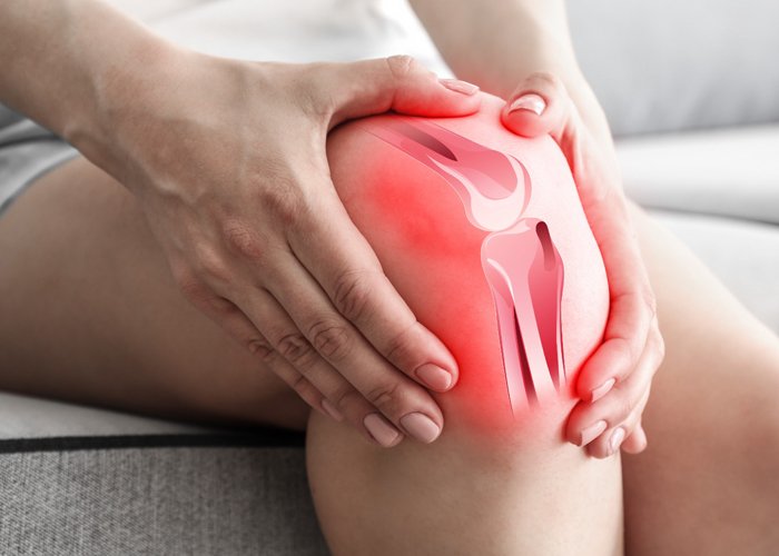 Physiotherapy treatment for knee replacement rehab