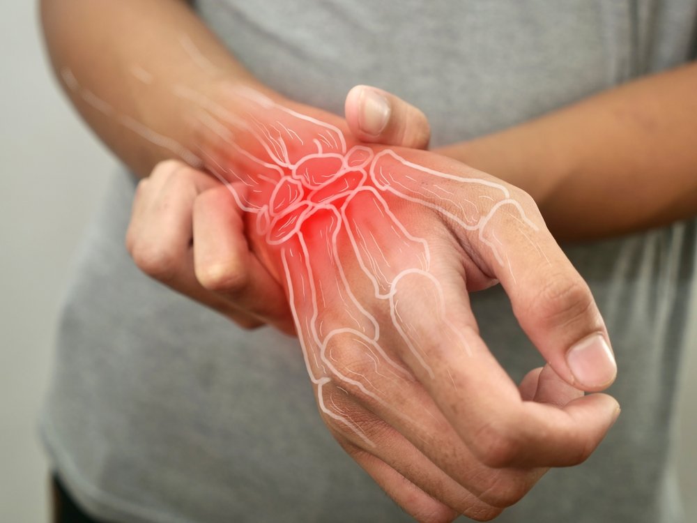 Rheumatoid Arthritis: Symptoms, Causes, and Effective Treatment